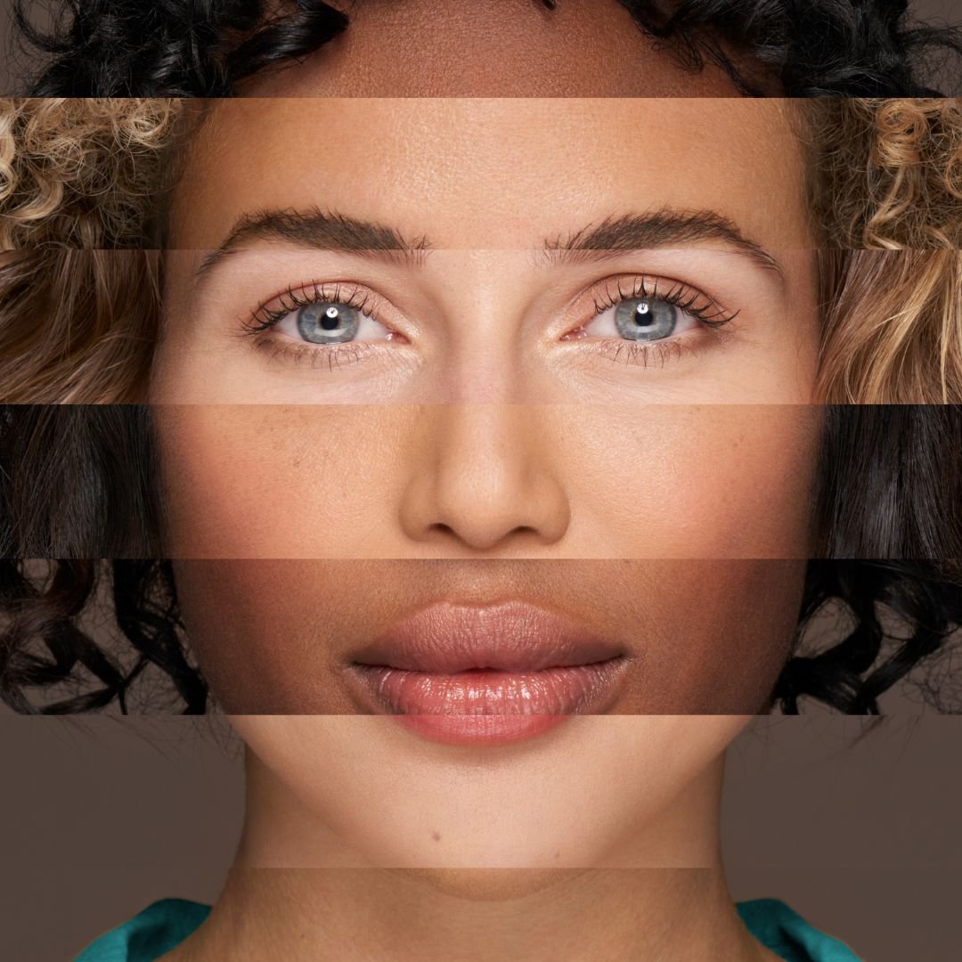 Azzalure Key Visual - Model Shot