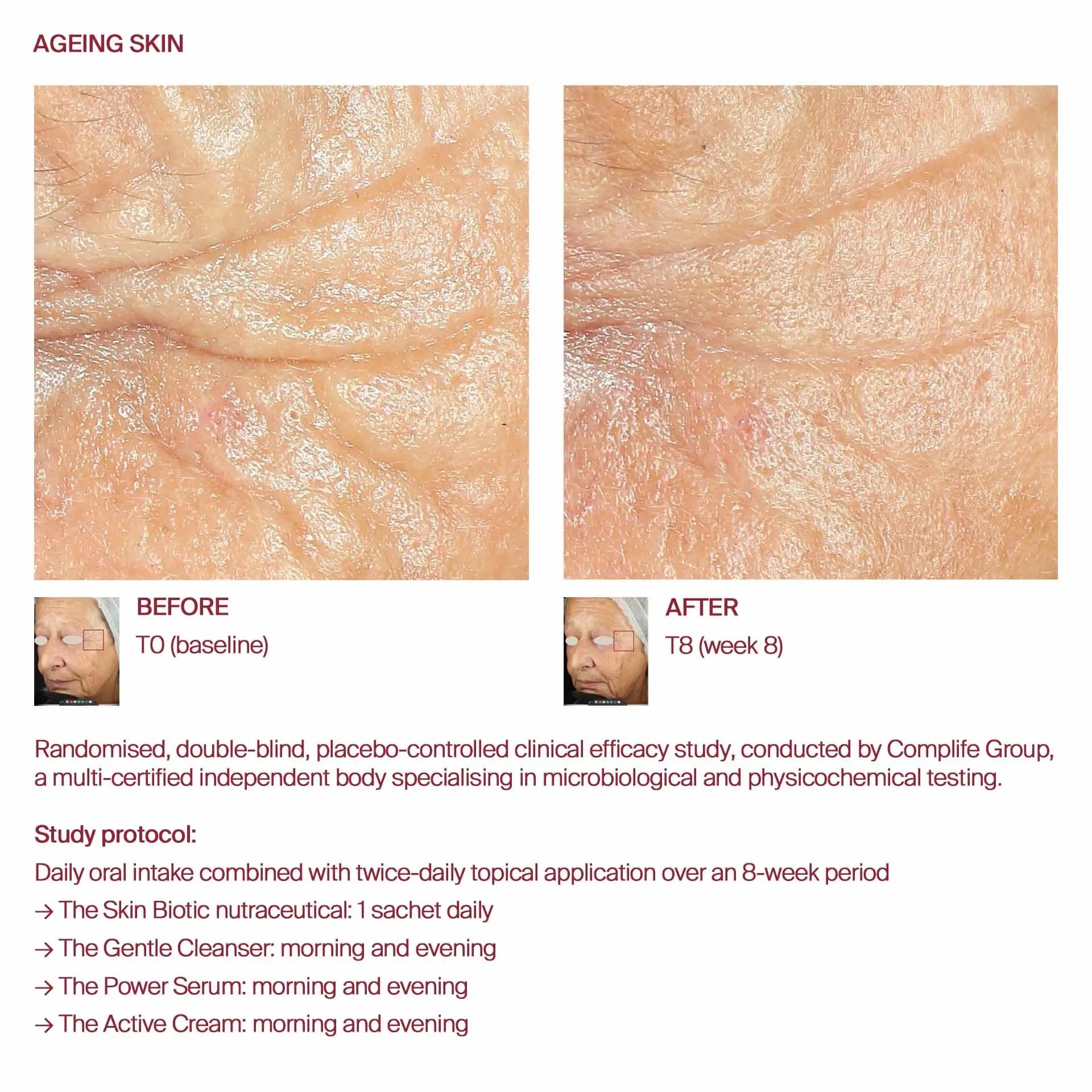 AWvi before and after ageing