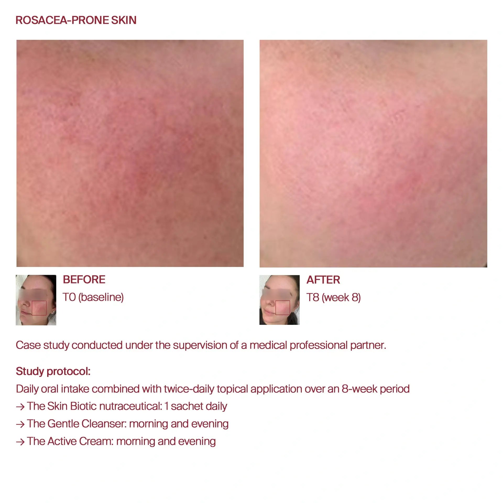 AWvi before and after sensitive