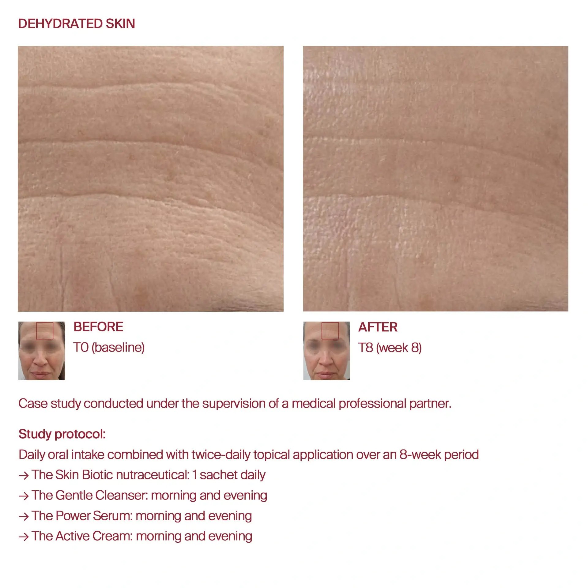 AWvi before and after dehydrated