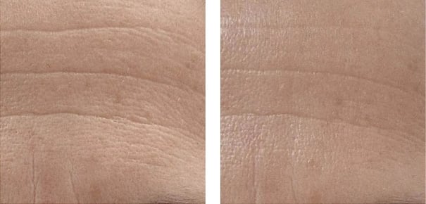 Dehydrated skin before and after