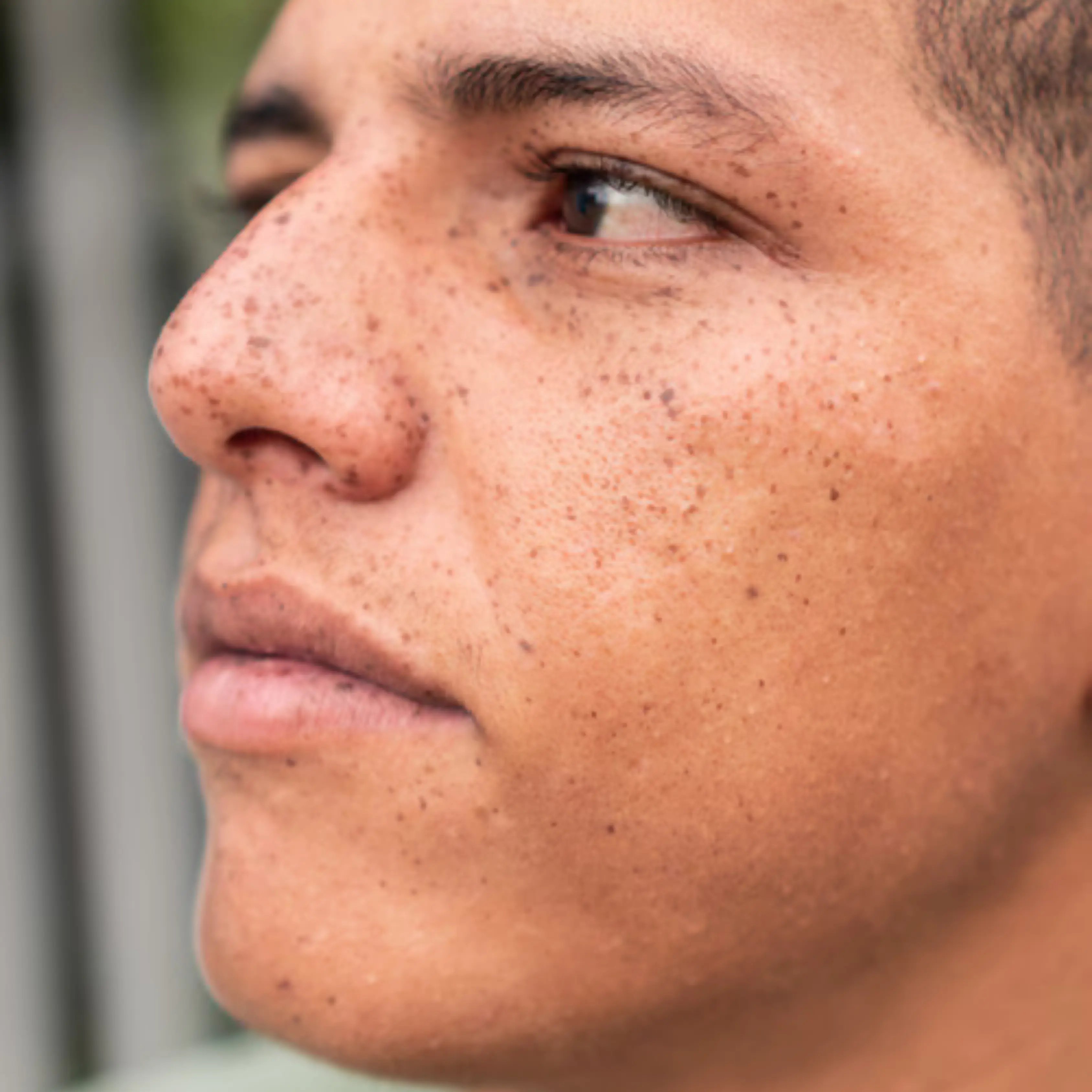 Pigmentation male model shot