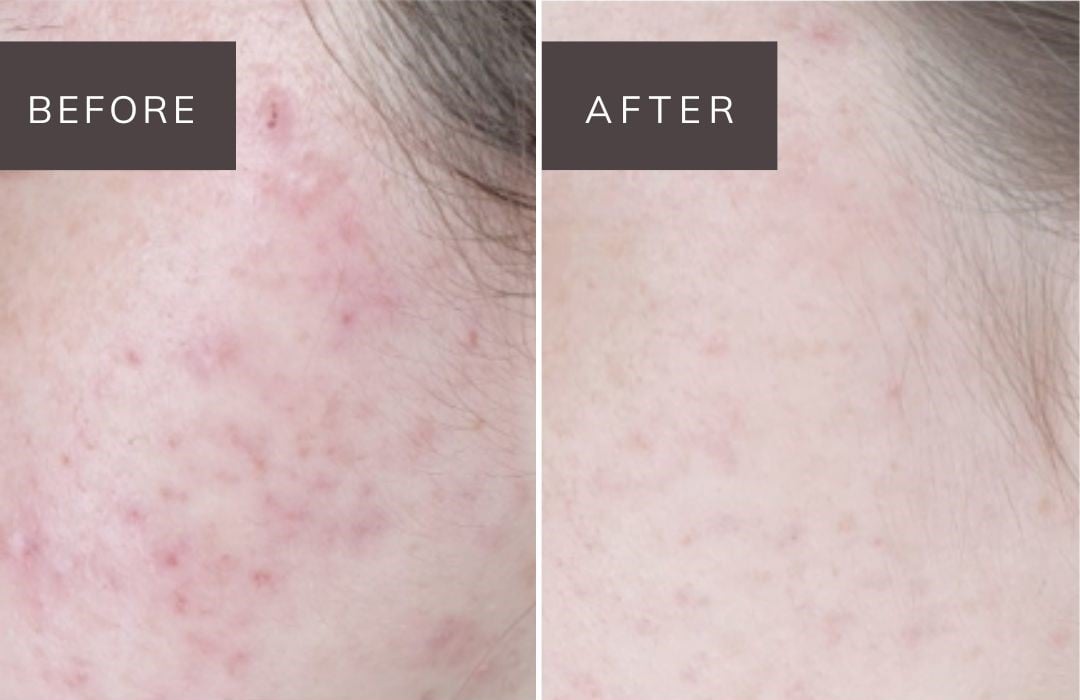 noon before and after