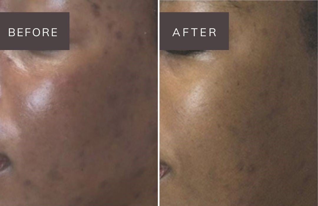 noon before and after